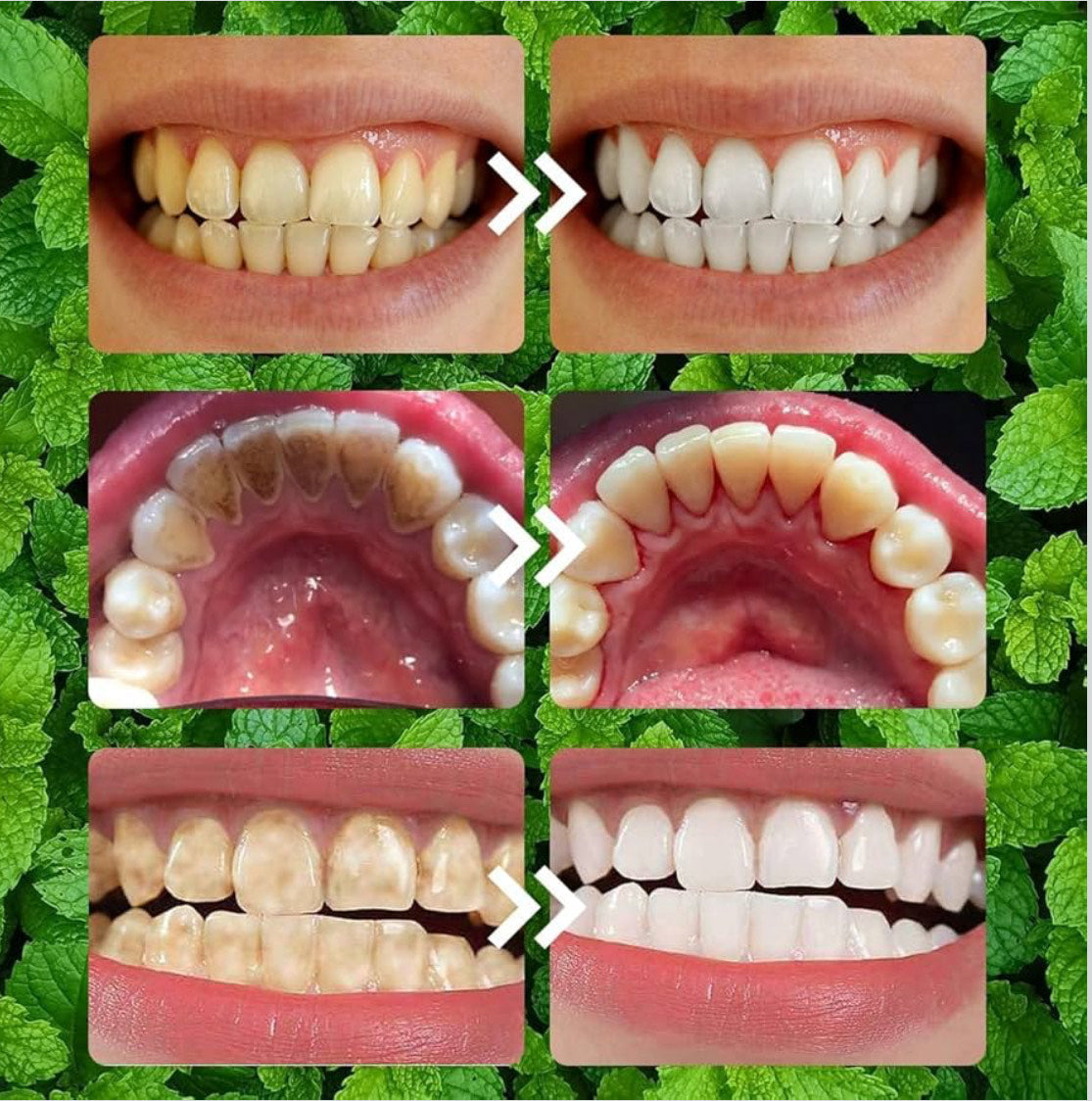 Teeth Restoration Mineral Powder